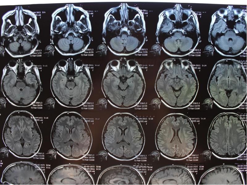 Подготовка к МРТ головного мозга
