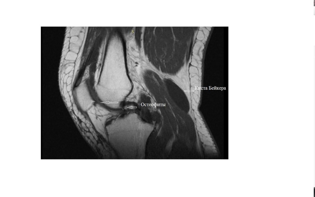 Как делают мрт коленного сустава взрослого фото сколько времени