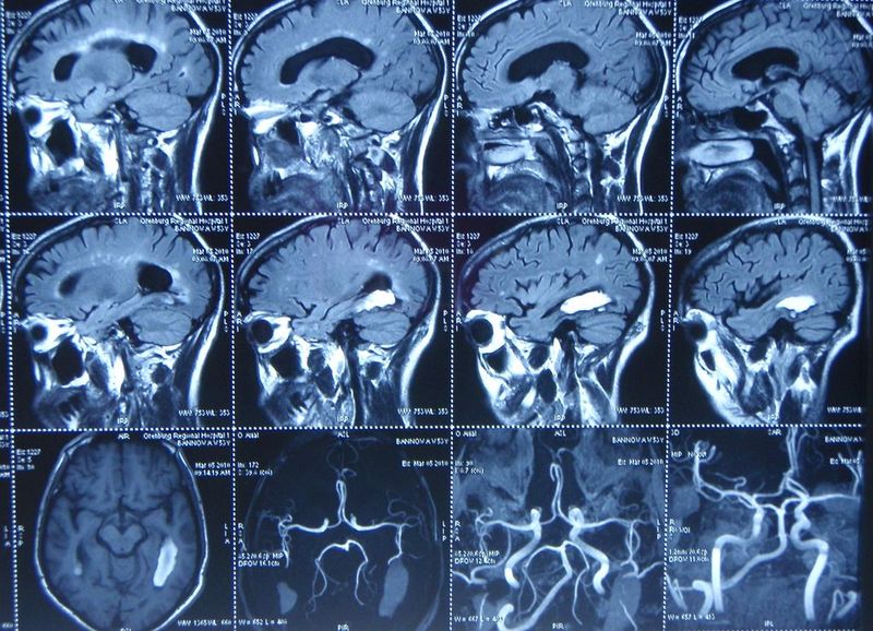 МРТ головного мозга в разных проекциях