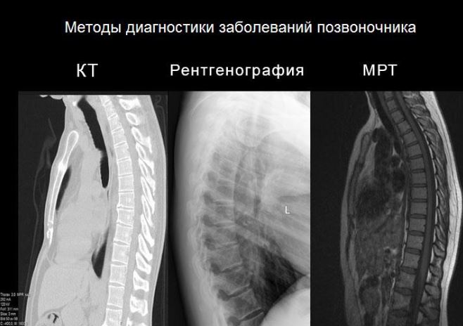 Мрт грудного отдела фото